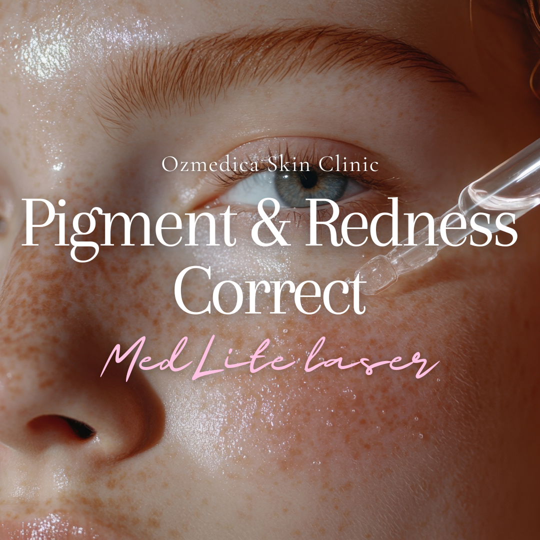 Pigment & Redness Correct Package (Laser + LED Program)