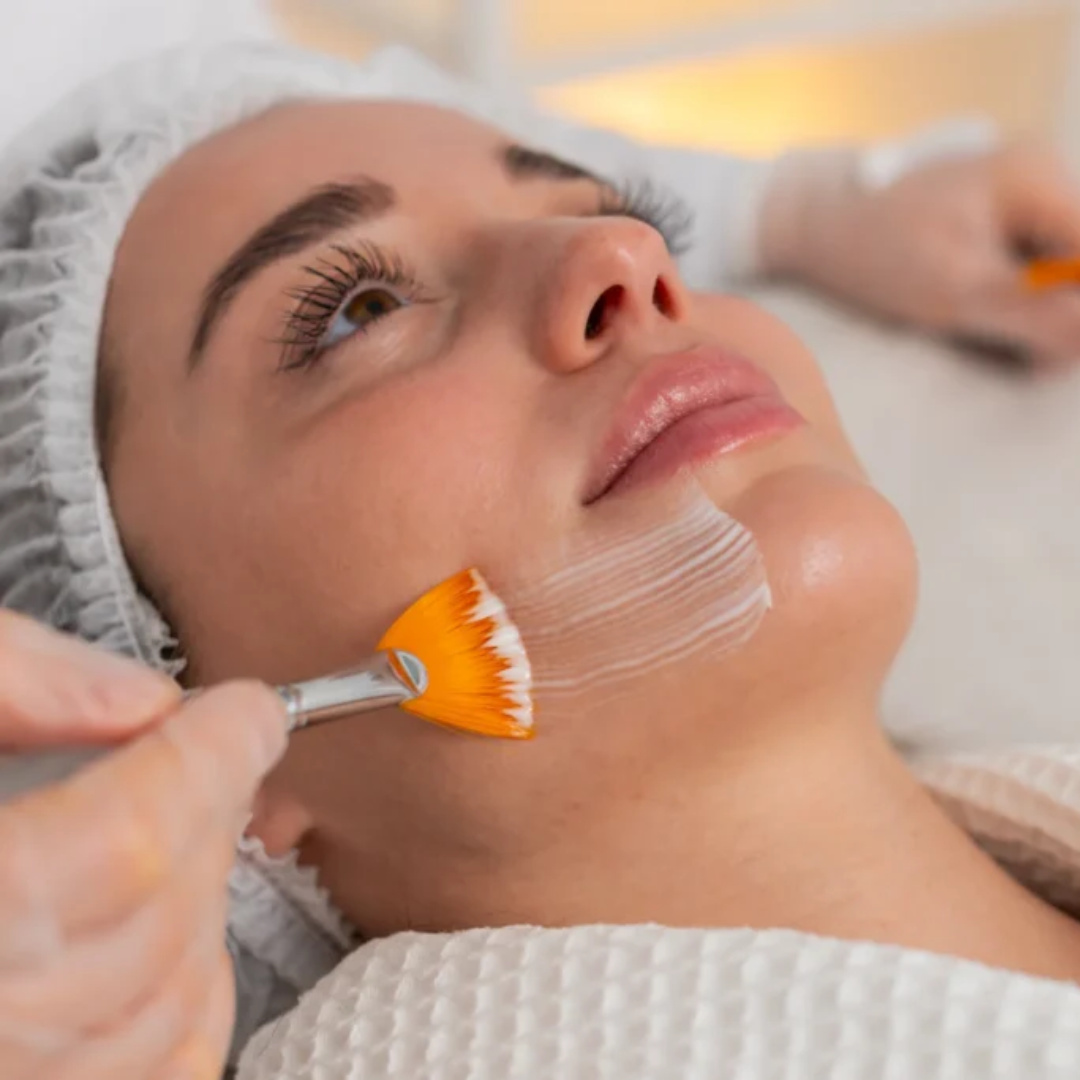 Superficial Lactic Peel (30 Mins | 1 Session)