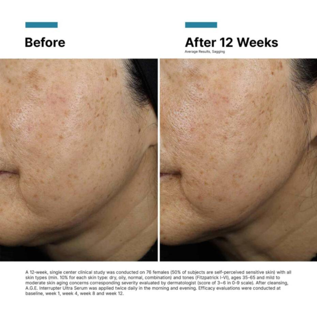 SkinCeuticals A.G.E. Interrupter Ultra Serum 30ml