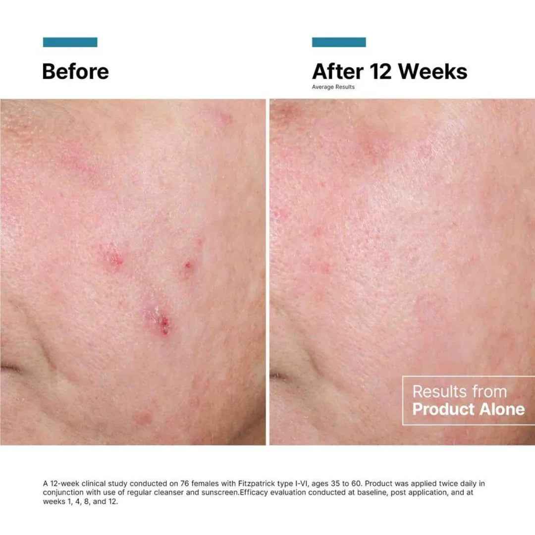 SkinCeuticals Advanced RGN-6 50ml