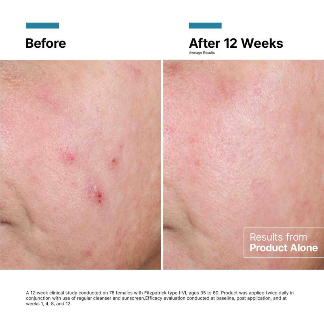 SkinCeuticals Advanced RGN-6 50ml