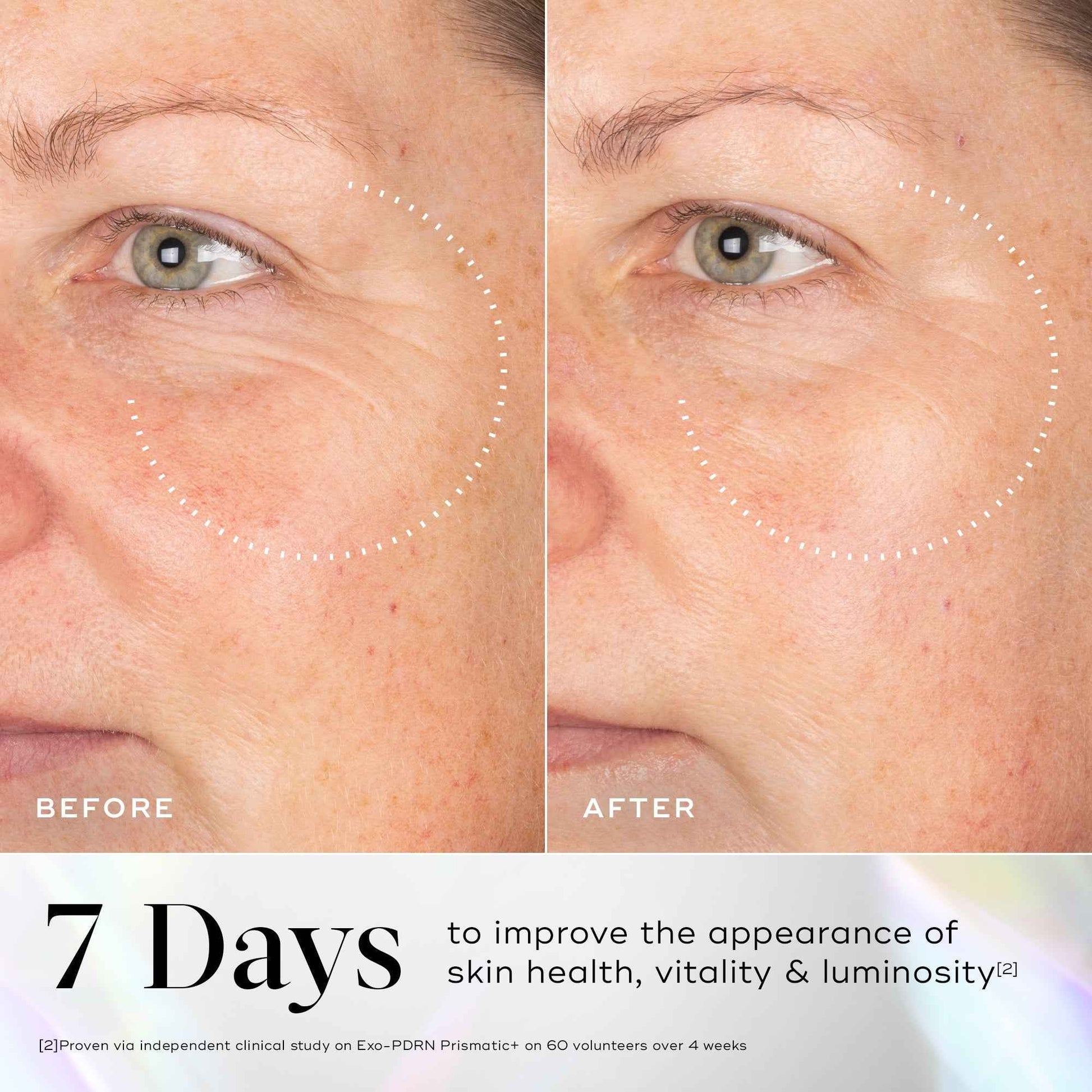 Medik8 Exo-PDRN Prismatic+ 30ml - Ozmedica
