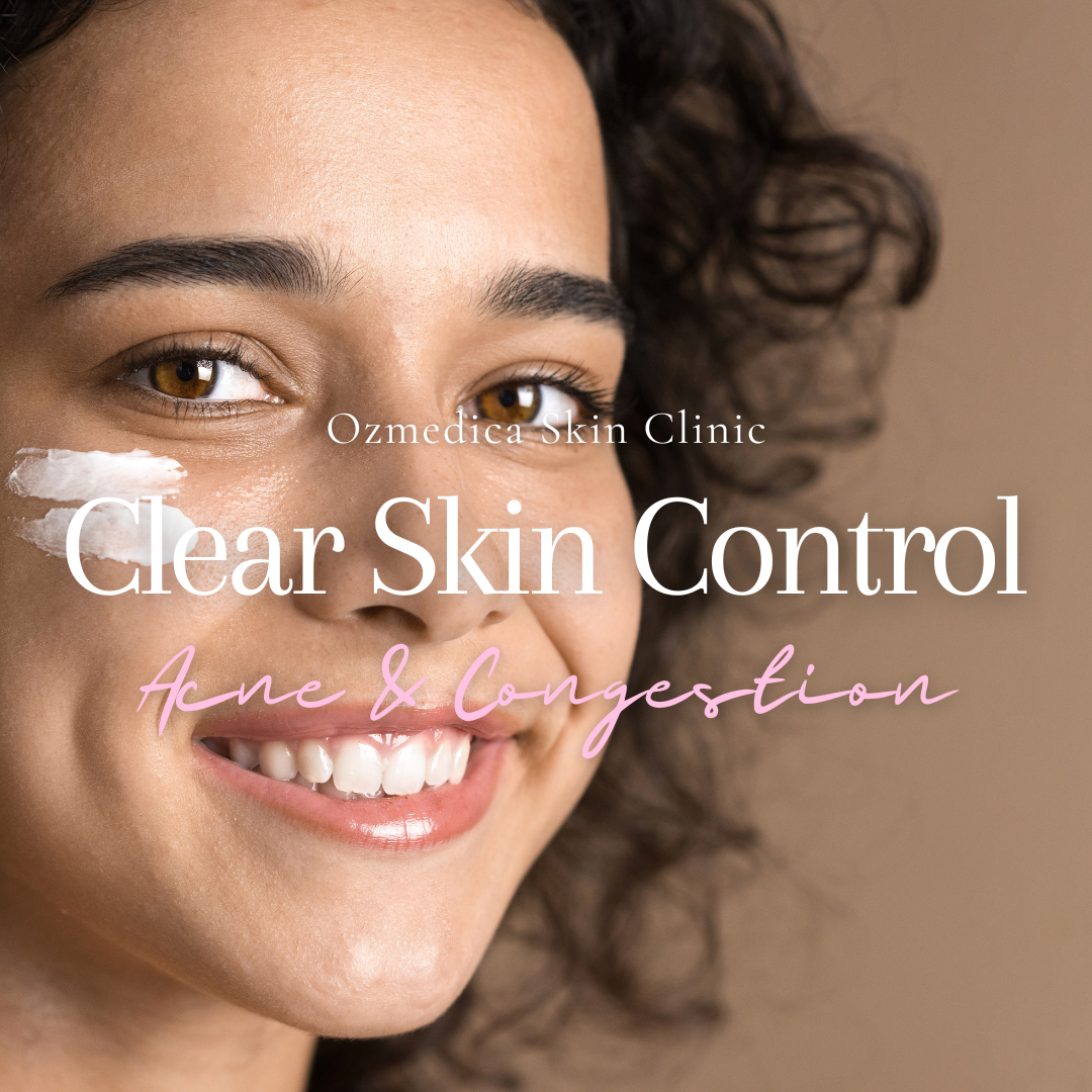 Clear Skin Control – Acne & Congestion Program Package