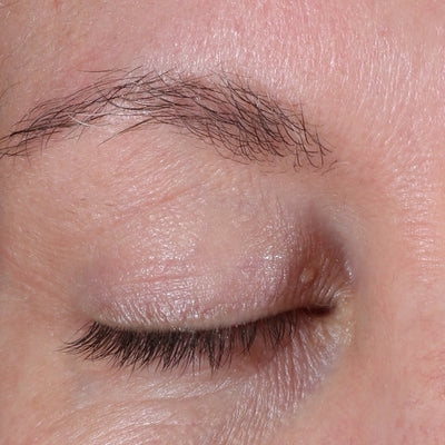 ALASTIN Restorative Eye Complex 18mL clinical result after image two