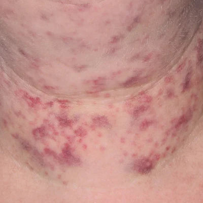 ALASTIN INHANCE® Serum 10mL clinical result before image one